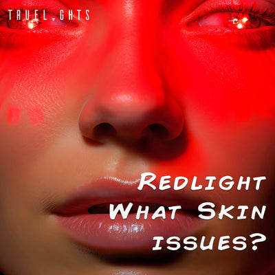 Illuminating Health: Red Light Therapy's Transformative Impact on Skin Health